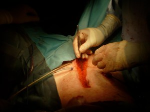 Stitching me back up