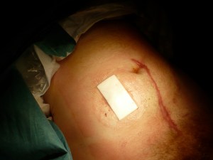 Op 2 - Everything all connected and stitched up